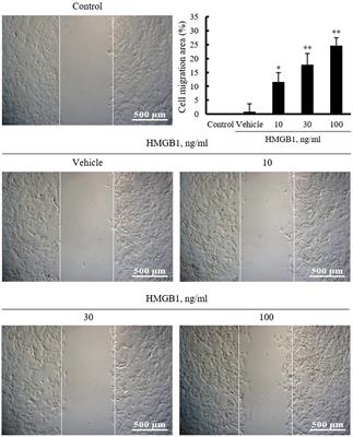 A Pivotal Role for AP-1-Mediated Osteopontin Expression in the Increased Migration of Vascular Smooth Muscle Cells Stimulated With HMGB1